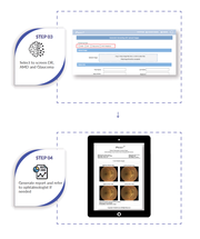 iHealthScreen Awarded US Patent on Glaucoma Detection Based on AI and Color Fundus Imaging image