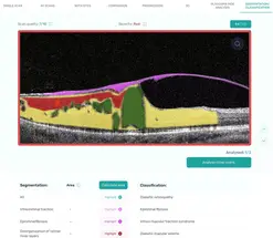 AI-Diagnostics Startup Altris AI Raises $1 Million to Scale AI-Based Eye Care Diagnostics Platform image