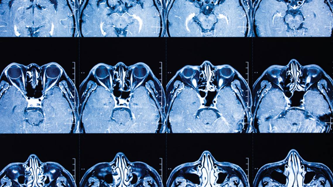 Rare But Not Impossible