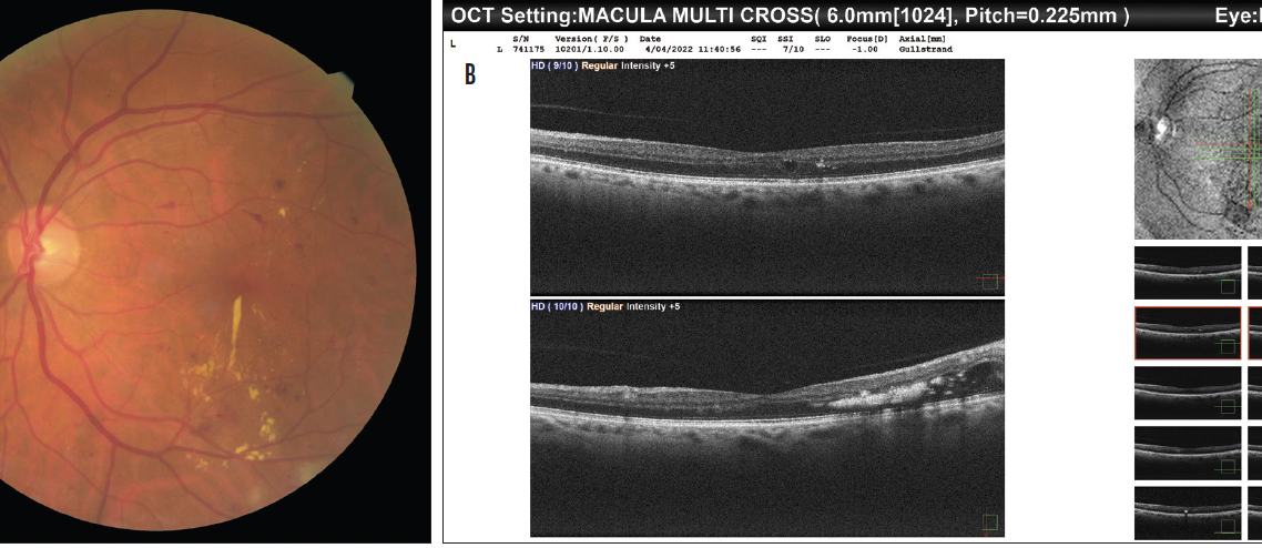 Making the Most of OCT Imaging