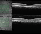 The Importance of Collaborative Care for Patients With Diabetic Retinopathy