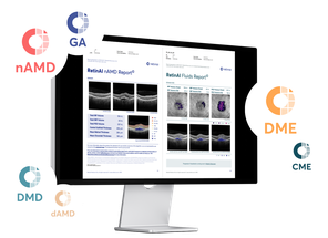 EssilorLuxottica Acquires RetinAI, Maker of AI and Data Management Technology image