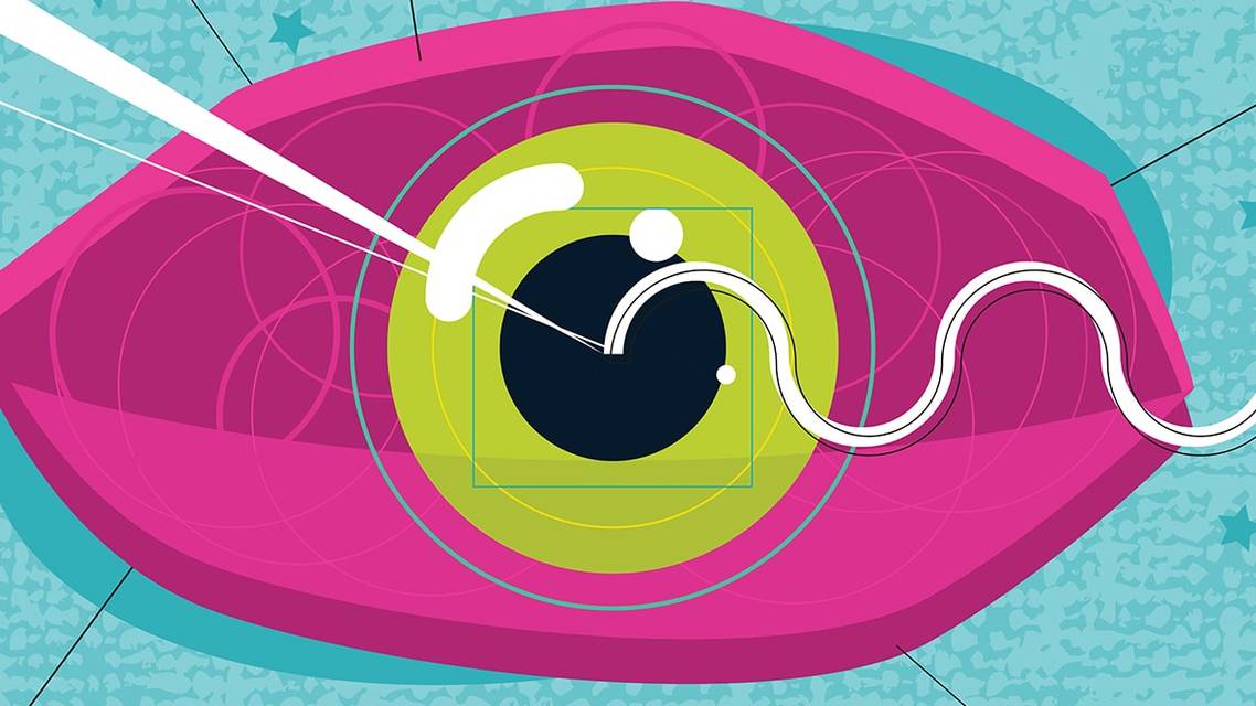 Corneal Dystrophies 101