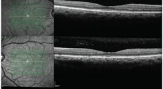 The Importance of Collaborative Care for Patients With Diabetic Retinopathy