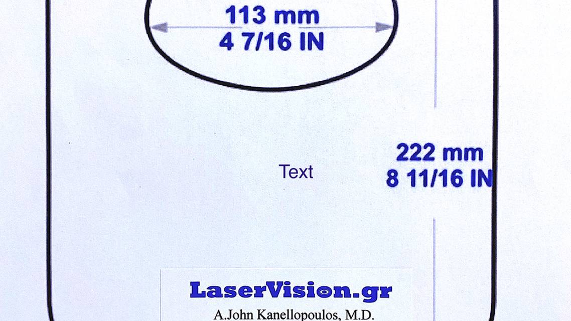Slit Lamp Droplet Shield