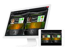 Topcon Achieves ISO 27001 Certification of its Harmony RS Clinical Data Management System image