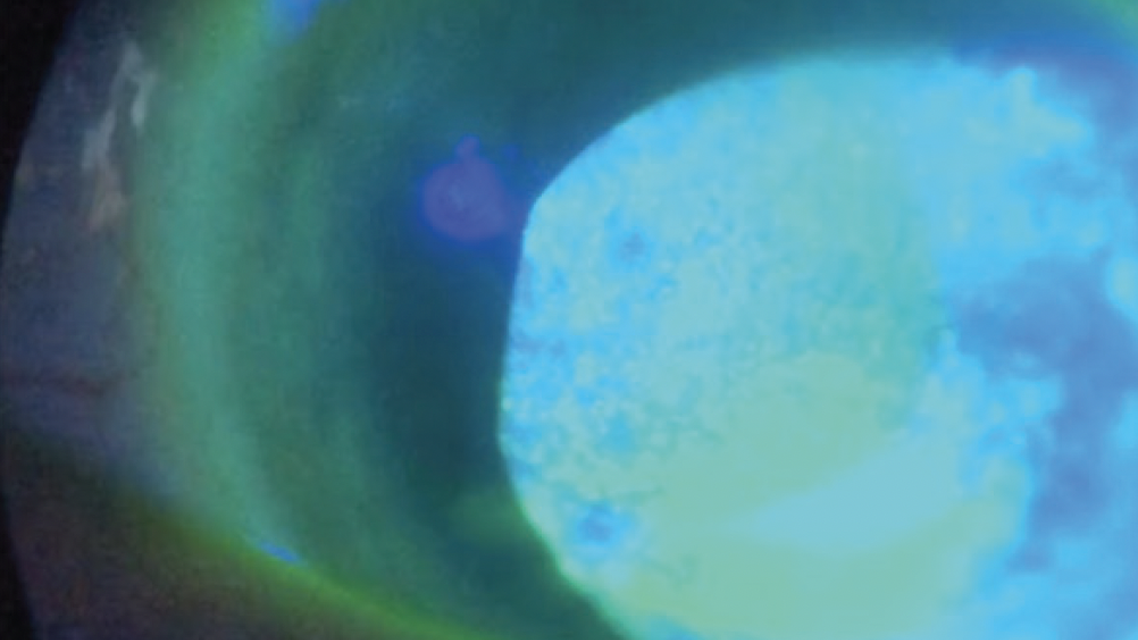 When 20Happy Falls Short