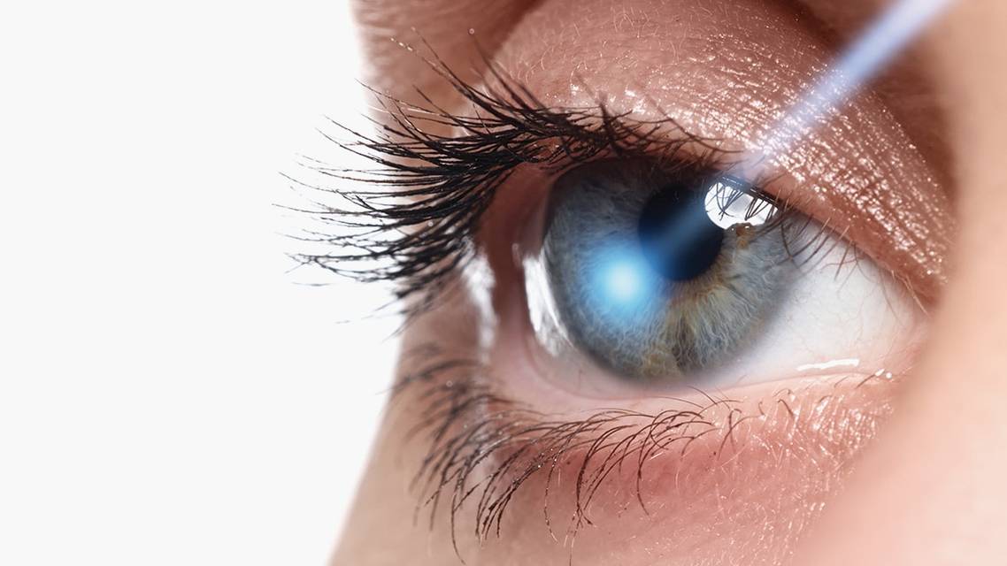 The Changing Role of Laser in Glaucoma