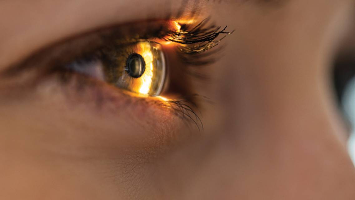 A Two Pronged Approach to Keratoconus Management