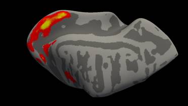 New Penn Study Finds Promising Model for Restoring Cone Function image