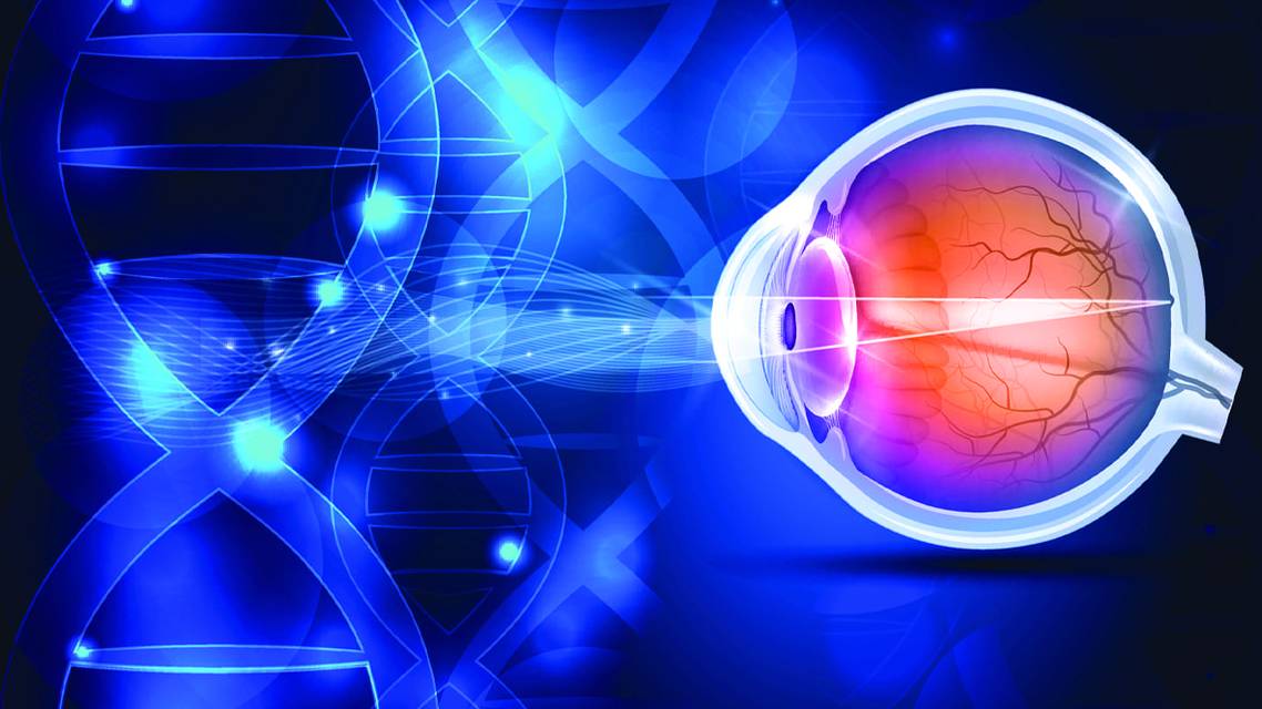 Gene Therapy and Inherited Retinal Disease