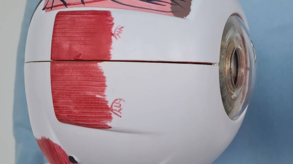 The Role of Nutrition in Glaucoma Care