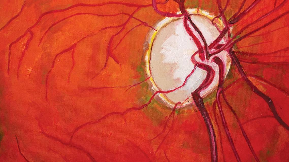 Forward Progress in Glaucoma Management