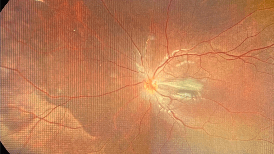 Collaborative Case 006 Red Tied