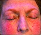 closed eyelids