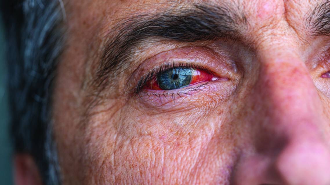 One More Issue if You Please