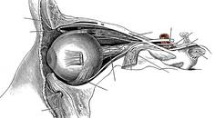 Orbital Disorders