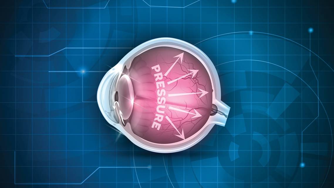 Making Headway in the Treatment of a Common Disease