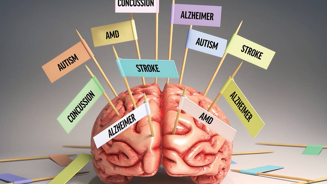 Neural Processing and Visual Performance