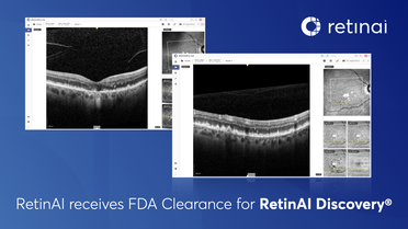 RetinAI Receives FDA Clearance for Discovery Image Management Platform for Ophthalmology image
