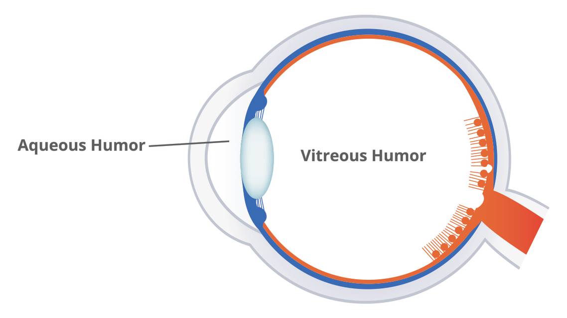 When Aqueous Humor Is No Laughing Matter