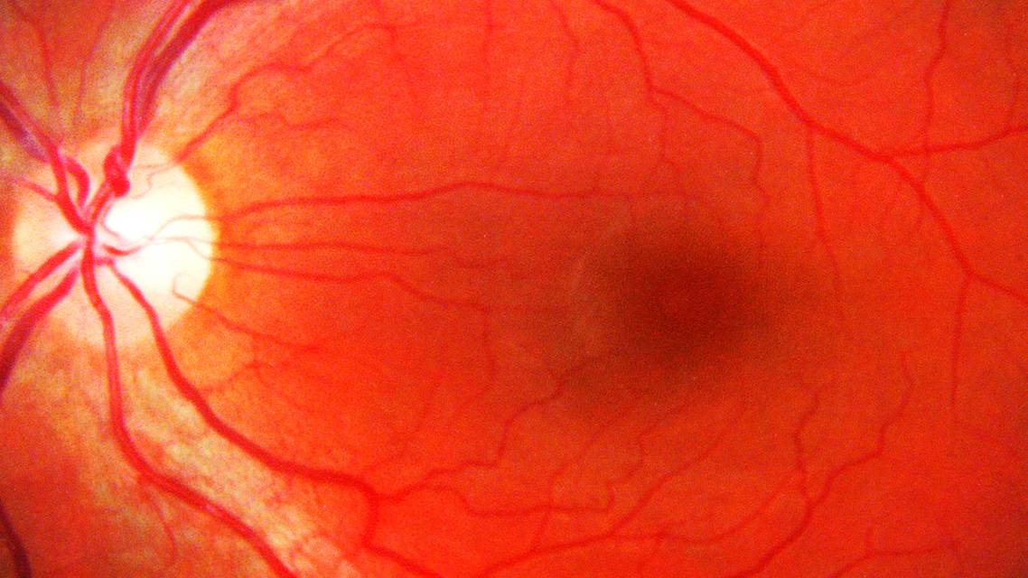 The Optometric Retina Society