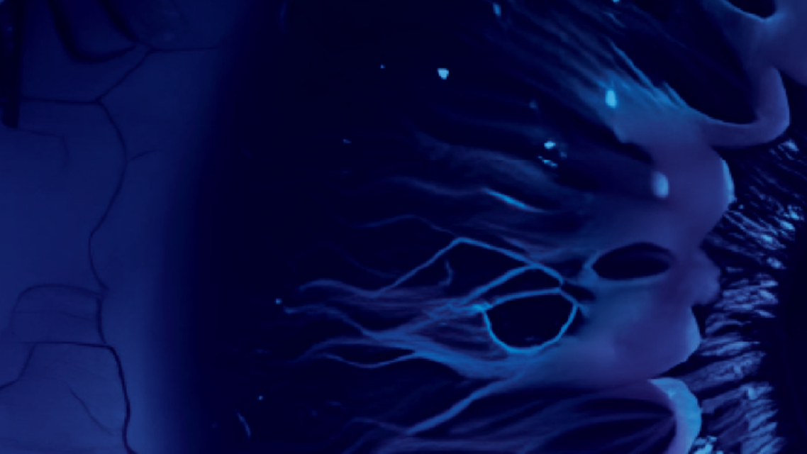 Modern Management of Dry Eye Disease