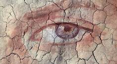 Essentials for Diagnosing OSD