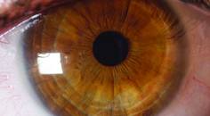 Five Rules of Thumb for Managing the Ocular Surface