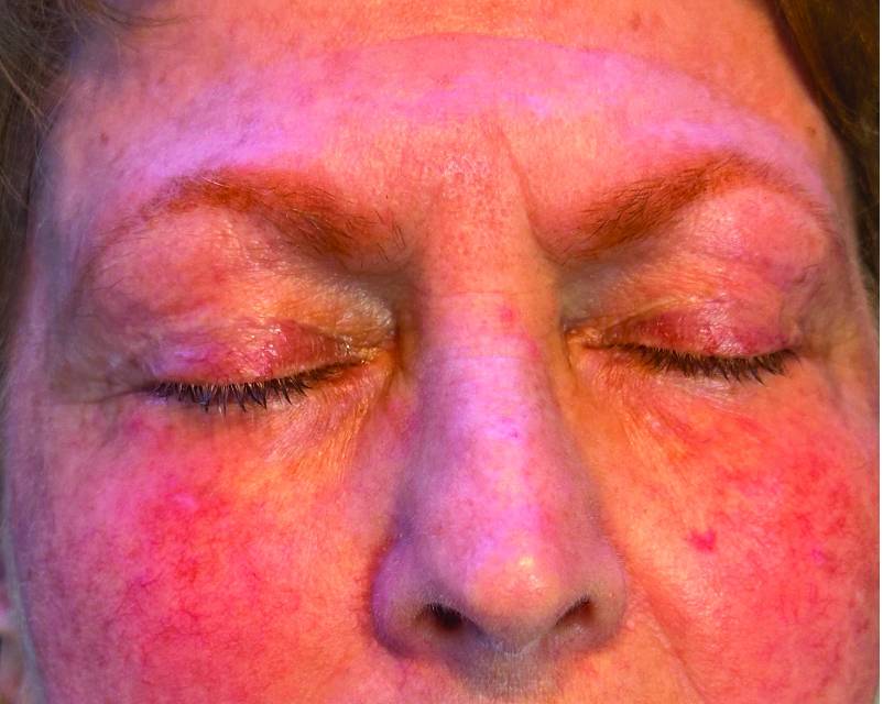 closed eyelids