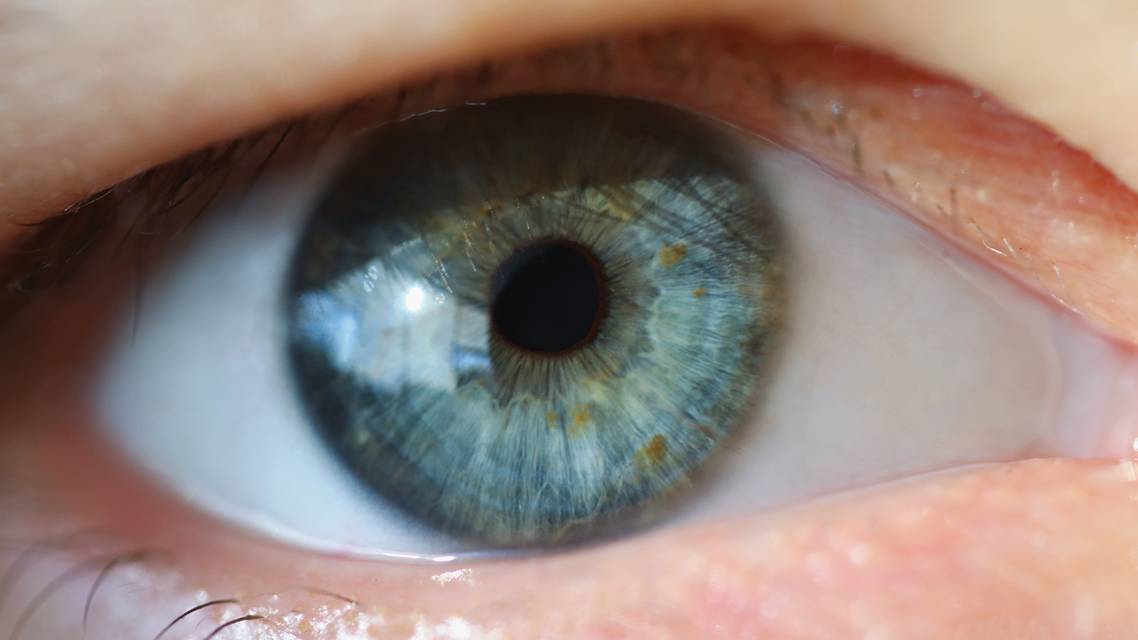 Navigating Measuring and Evaluating Ocular Ptosis