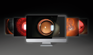 Haag-Streit Announces the Winners of the ‘Slit Lamp Imaging Competition 2022’ image