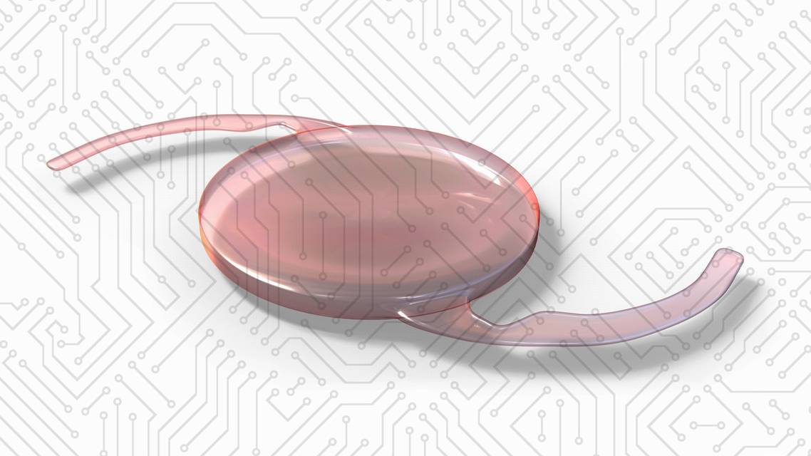 Innovations in IOL Technology