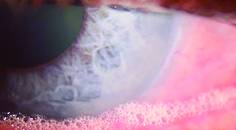 Saponification
