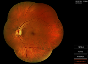 Visionix Unveils the VX 610 Automated Fundus Camera image