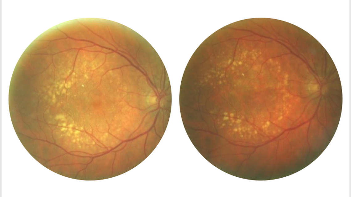 Collaborative Case 004 The Elephant in the Room