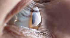 Managing Keratoconus With Scleral Lenses