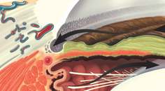2024 Glaucoma Pipeline