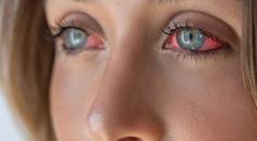 The Role of Inflammation and Immune Response in Dry Eye