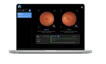 FDA Clears AEYE Health's Autonomous AI for Portable Diabetic Retinopathy Screening image