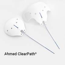 New World Medical Launches Ahmed ClearPath ST, Expanding Options for Glaucoma Surgery image