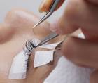 Managing Demodex Blepharitis in Eyelash Extension Wearers