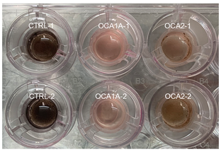 NIH Researchers Develop First Stem Cell Model of Albinism to Study Related Eye Conditions image