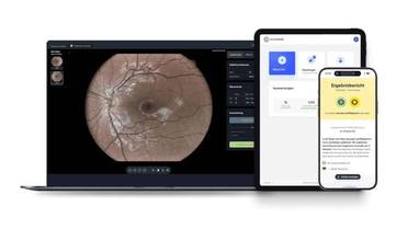 Zeiss Vision Care Acquires Stake in Ocumeda, Maker of Tele-Ophthalmology Platform image