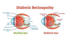 A New Ally in the Diagnosis and Management of Diabetic Retinopathy
