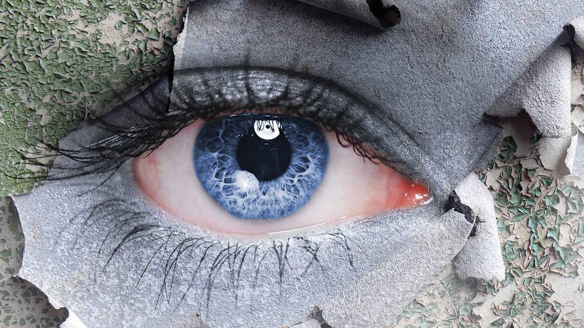 Managing Dry Eye Flares