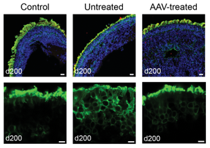 NIH Researchers Develop Gene Therapy for Rare Ciliopathy image