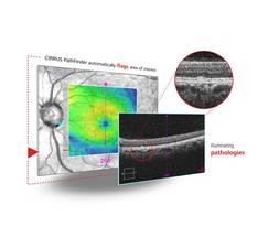 Zeiss to Showcase Expansion of Ophthalmic Care Options; New Refractive and Cataract Milestones at ESCRS image
