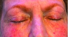 closed eyelids