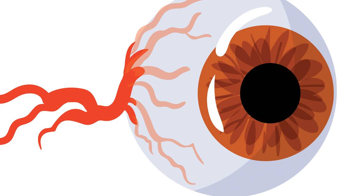 TRPn Out OSD Inflammation and Nerves